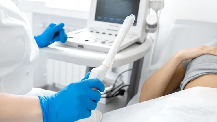 Exame de Ultrassom Transvaginal em Montes Claros, MG