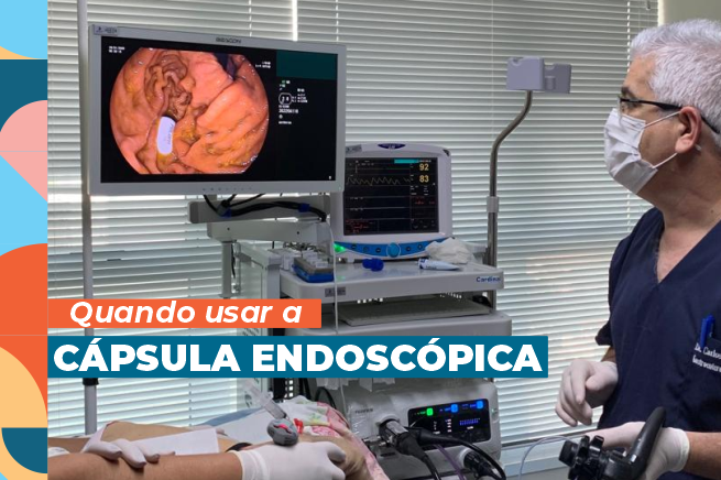 Quando usar a cápsula endoscópica?